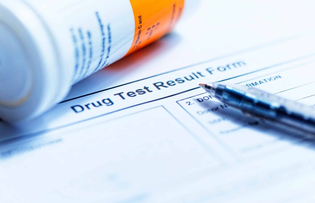 Does acid show up on a drug test?